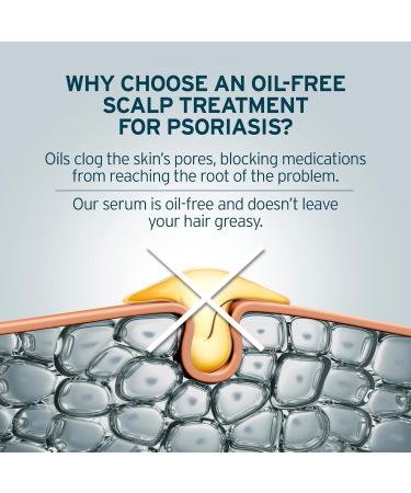 Psoriasis Treatment Serum with Salicylic Acid - Relieve Dry, Itchy Scalp & Skin Conditions - 1.7 fl. Oz - Buy Online on GoSupps.com