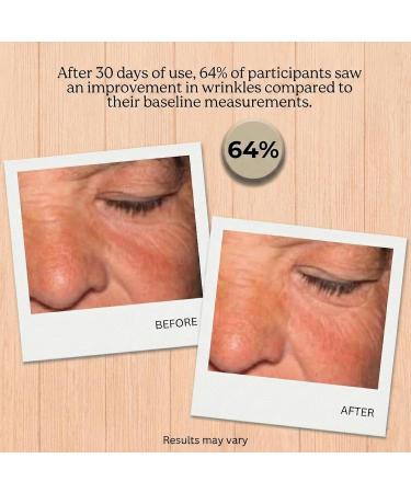 Yunasence GENELYSSE Advanced Lifting and Firming Night Recovery Complex, with Matrixyl 3000, Retinol & Plant Stem Cells. - Buy Online on GoSupps.com