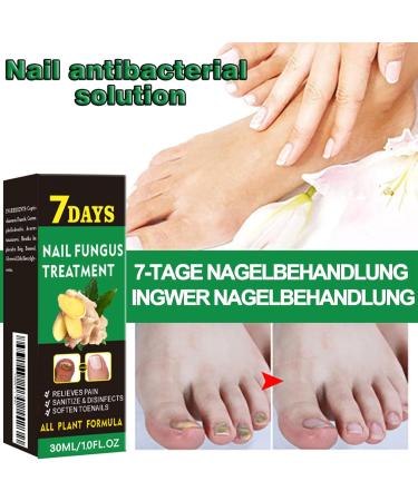 MrCuvaryas Ginger Nail Care Oil Nail care oil Nail care serum for brittle discolored and broken nails ginger cuticle care oil for nails nail care oil nail hard nail care for - Buy Online on GoSupps.com