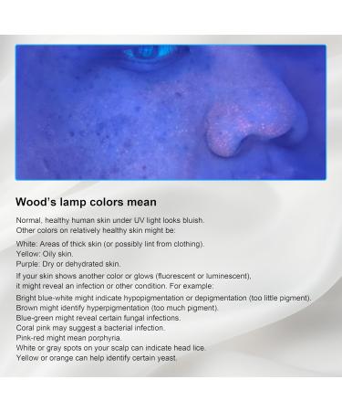 Elitzia Portable Beauty Salon Wood Lamp - USA Stock Facial Skin Care Analyzer | 3X Magnifying Lamp with Plastic Slide Cover ETSP023 for Flawless Skin Care - Buy Online on GoSupps.com
