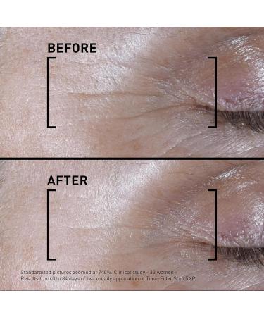 Filorga Time-Filler Shot Serum | Neuropeptide & Polysaccharides for Hydration Firming & Expression Lines - 0.5 fl. Oz - Fast Shipping Worldwide - Buy Online on GoSupps.com