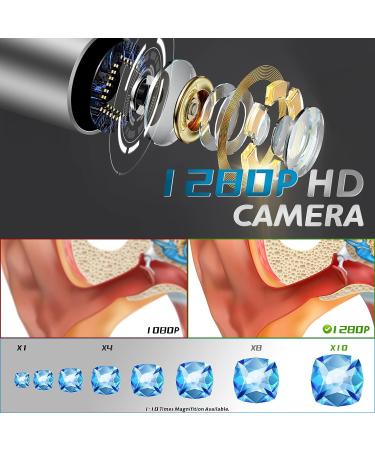 Wireless Earwax Otoscope with Charging Station and 14 Cleaning Tools | 3M High-definition Camera | 3-level LEDs | for iOS & Android - Buy Online on GoSupps.com