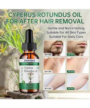Cyperus Rotundus Oil For Hair Removal Pure & Organic Cyperus Oil For Women & Men Reducing Body Hair Growth 60ML Hair and Body Oil Moisturizing & Soothing. 60ML-1 PCS 1 Fl Oz (Pack of 1) - Buy Online on GoSupps.com