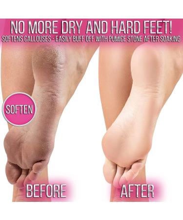 Jelly Pedicure Foot Soak for Dry Cracked Feet - Moisturizing Spa Pedi Soak with Damascus Rose - Foot Bath Salts for Relaxation - Foot Gel for Sore Feet - Buy Online on GoSupps.com