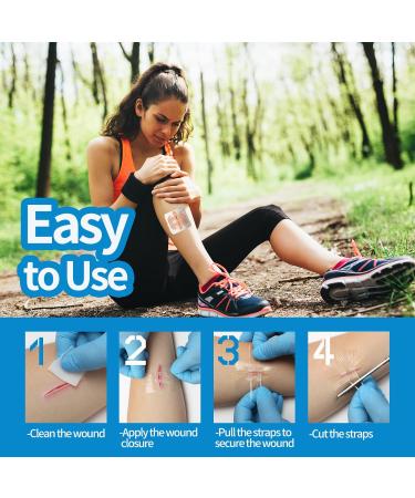 Emergency Laceration Closures - Zipstitch Wound Closure Device (4 Set) | Easy Use No Stitches Ideal for Home & Outdoors - Buy Online on GoSupps.com