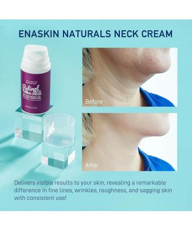 Retinol Neck Firming Cream - Advanced Face Tightening & Lifting | Hyaluronic Acid Collagen & Vitamin C | Reduces Wrinkles & Firms Skin (2.7 Oz - Buy Online on GoSupps.com