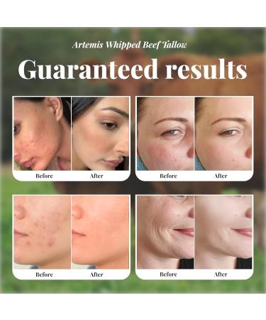 Beef Tallow for Skin - Beef Tallow face and body Balm Natural Cream 6 oz (Pack of 1) | Grass-Fed Beef Tallow All-Natural Moisturizer Whipped Beef tallow Cream for Smooth Skin Vitamins A C D E Lavender - Buy Online on GoSupps.com