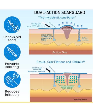 Scarguard Scar Treatment with Silicone & Vitamin E - 0.5 oz - For New & Old Scars - Buy Online on GoSupps.com