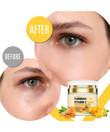 Turmeric + 30% Vitamin C Anti-Aging Cream | Face Glow Moisturizer & Skin Repair - Acne Relief Even Tone Fade Scars | 1.7 FL OZ - Buy Online on GoSupps.com