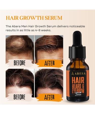 ABERA Hair Growth Serum with Biotin & Castor Oil | Natural Regrowth for Stronger Thicker Hair Beard & Eyebrows for Men & Women - International Shipping Available - Buy Online on GoSupps.com