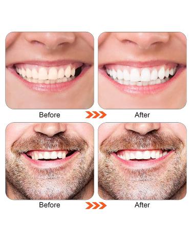 Tooth Repair Kit - Natural Shade Temporary Filling for Missing or Broken Teeth - 6PCS - Buy Online on GoSupps.com