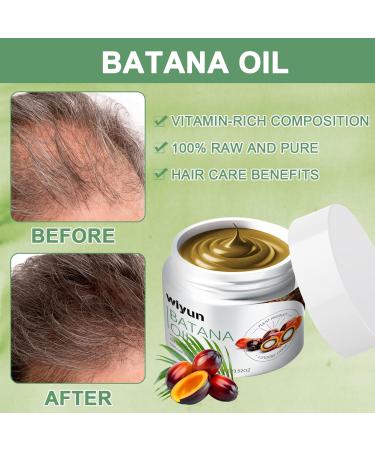 Batana Oil Batana Oil for Hair Pure Batana Oil Batana Oil for Hair Contains 100% Batana Oil Batana Oil for Hair Makes Hair Thicker (100G) - Buy Online on GoSupps.com