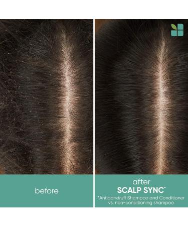 BIOLAGE Scalp Sync Anti-Dandruff Shampoo - Controls Flakes & Soothes Scalp | Dandruff Control | Paraben-Free | Vegan - 33.8 Fl Oz - Buy Online on GoSupps.com