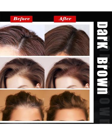 Greyghost Volumizing Hair Powder for Men - Dark Brown Root Touch Up & Hair Cover Up for Thinning Hair - International Shipping Available - Buy Online on GoSupps.com
