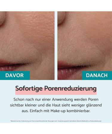 Remescar Immediate Pore Reduction Serum 20ml - Smooths & Minimizes Pores 180 Applications - Clinically Tested - Buy Online on GoSupps.com