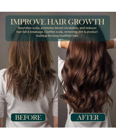 Rosemary & Biotin Pre-Wash Scalp Oil - Hair Growth Treatment for Healthy Scalp & Reduced Hair Fall | 2 Fl Oz - Buy Online on GoSupps.com