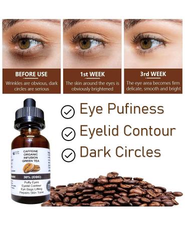 Puffy Eyes Caffeine & Green Tea Serum - Natural Ingredients, Alcohol-Free - Buy Online on GoSupps.com