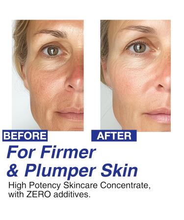 100% Pure Volufiline & Bakuchiol 30 000 ppm Concentrate Serum - Skin Firming Solution High Potency Retinol Alternative | Anti-Wrinkle Boosts Collagen for Aging Sagging Mature Skin - Buy Online on GoSupps.com