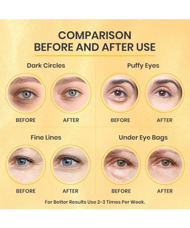 24k Gold Under Eye Patches - Reduce Dark Circles & Puffiness | 7 Pairs of Gold Foil Masks with Betaine & Hyaluronic Acid for All Skin Types - Buy Online on GoSupps.com