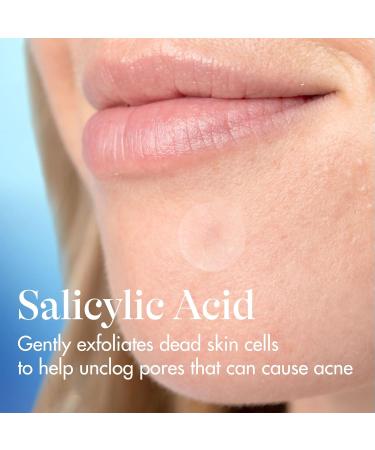 Differin Acne Fighter Pack Differin Gel Retinoid Acne Treatment For Face with 0.1% Adapalene 15g Tube + Salicylic Acid Pimple Patches 36 Count Designed for Pimple and Acne-Prone Skin - Buy Online on GoSupps.com