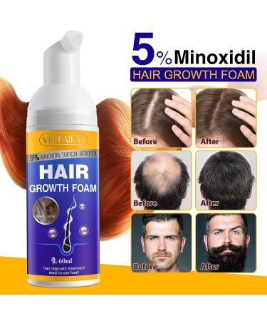 Minoxidil 5% Foam for Men and Women | Biotin Hair Regrowth Treatment | Stop Thinning and Hair Loss | 1 Month Supply - Buy Online on GoSupps.com