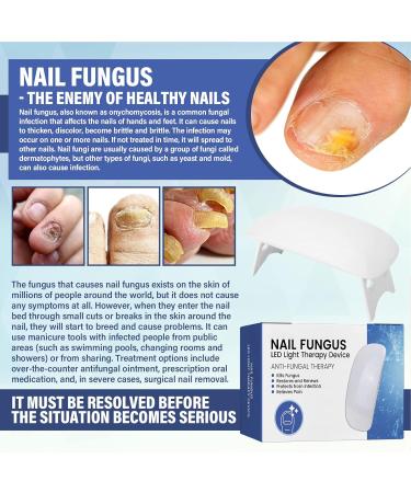 NailPro Nail Fungus LED Light Therapy Device Nail Fungus Laser Nail Fungus Treatment Home Use Nail-Fungus Remover for Toenail Fingernails & Onychomycosis (A01) - Buy Online on GoSupps.com