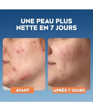 NIVEA Derma Skin Clear Daily Exfoliating Night Care (1 x 40 ml) Night care 8% salicylic & glycolic acids & niacinamide Anti-blackhead face cream for blemish-prone skin - Buy Online on GoSupps.com