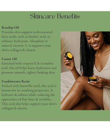 Beauty Glow Frankincense Resin Infused Balm Organic Castor & Rosehip Oils Frankincense Moisturizer Miracle Rub for Muscles & Joints Dry Sensitive Skin Body Hands & Face Natural Skin Care - Buy Online on GoSupps.com
