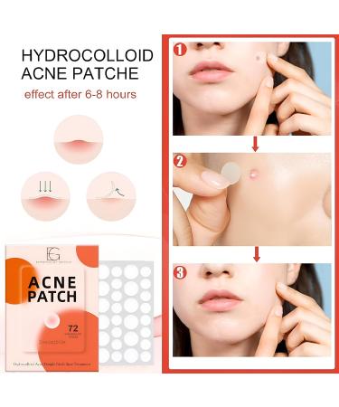 Fast-Acting Hydrocolloid Acne Patches | 72 Invisible Stickers for All Acne Types | Covers Pimples Hides Spots & Removes Oil - Shop Now - Buy Online on GoSupps.com