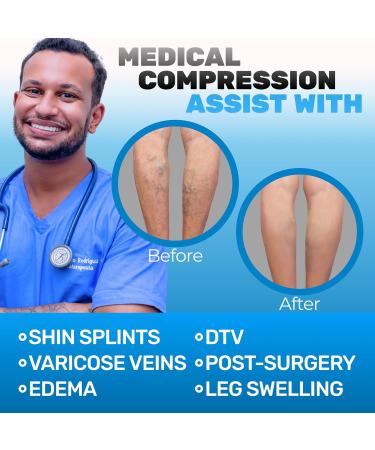 Buy ABSOLUTE SUPPORT Compression Socks for Men & Women - 15-20mmHg Knee High Medical Grade for Varicose Veins Circulation Edema | Black XX-Large - Fast International Shipping - Buy Online on GoSupps.com