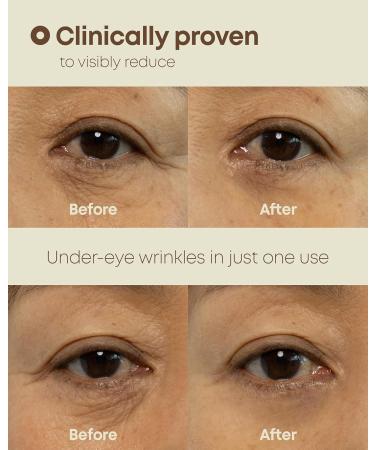 NINELESS Ever-Youth Dual Effect Eye Cream Korean Skincare Instant Lifting Technology for Firm Eyes with Niacinamide Adenosine Hyaluronic Acid Ceramides for Fine Lines Bags Puffiness 0.5 fl oz - Buy Online on GoSupps.com