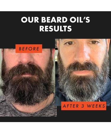 Men's Beard Oil - Conditioning Growth Oil with Natural Essential Oils for Softening, Hydrating, and Thickening - Reduces Flakes and Itch - Buy Online on GoSupps.com