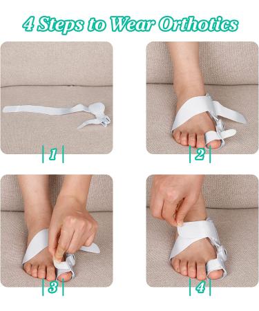 Bunion Corrector for Women and Men - Orthopedic Hallux Valgus Relief with Toe Separators and Hammer Toe Splint Pad - Buy Online on GoSupps.com