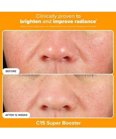 Paula's Choice Brighter Days Ahead Kit Vitamin C and AHA Trio Includes Travel Size C5 SPF Face Sunscreen Mandelic Acid Exfoliant C15 Vitamin C Booster Serum Brightening & Resurfacing 3-Piece Set - Buy Online on GoSupps.com