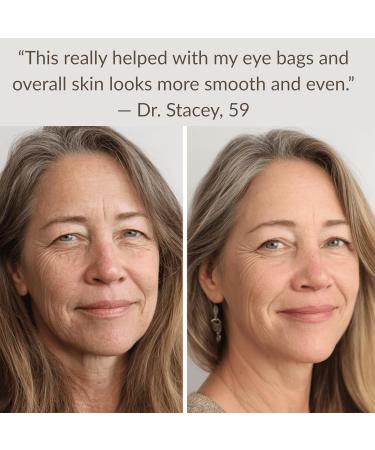 LeVaye Strateva RX Advanced Anti-Aging Serum Vitamin C Niacinamide Natural Retinol Hyaluronic Acid & Peptides Targets Wrinkles Fine Lines Dark Spots Dark Circles & Enlarged Pores - Buy Online on GoSupps.com