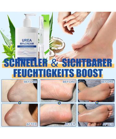MrCuvaryas 60 Urea Cream 200 ml foot care for foot cream very dry feet moisturizing and anticrack foot cream hand cream with nail care oil foot cream for cracked feet heels elbows - Buy Online on GoSupps.com