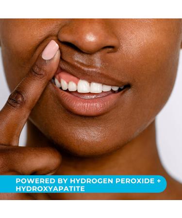 Niveus Teeth Whitening Strips - 7 Enamel Safe Treatments Dentist Grade Hydrogen Peroxide Hydroxyapatite Mint Flavor - Fast International Shipping - Buy Online on GoSupps.com