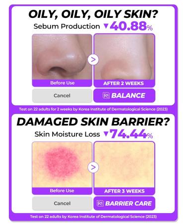 Soothing Repair Face Toner R4 | Hydrating & Moisturizing Toner for All Skin Types | Eucalyptus Peptide & Collagen | No Animal Trials Paraben-Free | 6.76 fl oz - Buy Online on GoSupps.com