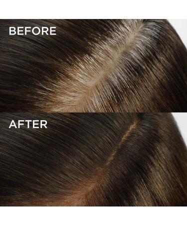 Root Rescue Light Blonde 9 - 2 Pack Hair Color Kit - Buy Online on GoSupps.com