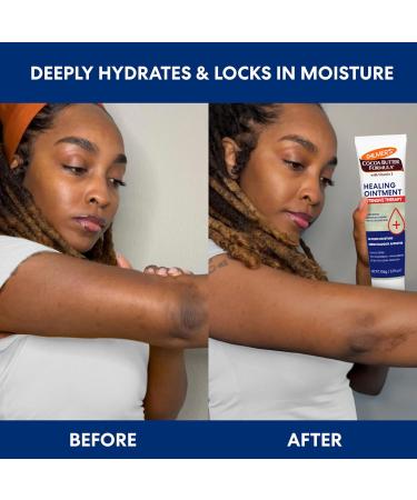 Palmer's Cocoa Butter Formula Healing Ointment with Vitamin E 3.75 Oz Intensive Therapy for Severely Dry Eczema Prone Skin Provides 48-Hour Moisture Non-Comedogenic Dermatologist Approved - Buy Online on GoSupps.com