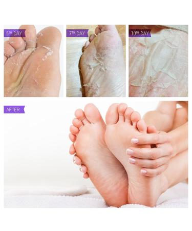 Foot Peel Mask for Baby Soft Feet - Exfoliate Calluses with Lavender and Aloe Vera - Callus Remover for Men and Women - 2 Pairs - Buy Online on GoSupps.com