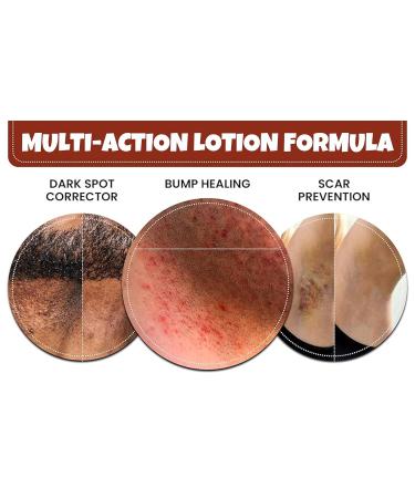 Buy Anti Bump Soothing Lotion | Fast International Shipping | Soothe Irritation & Redness - Buy Online on GoSupps.com