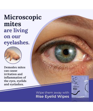 Cornea Care Rise Eyelid Wipes with Tea Tree Oil & Hyaluronic Acid - 30 Count | Dry Eye Relief and Cleanser | Travel Ready - Buy Online on GoSupps.com