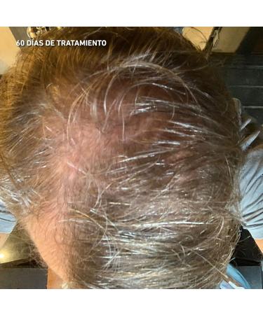 HEY JOE! - Power Hair Lotion | Anti-hair loss lotion formulated with plant stem cells Cruelty Free and vegan - 150 ml - Buy Online on GoSupps.com