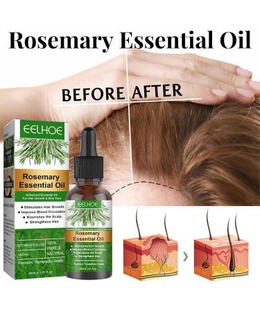 Organic Rosemary Castor Hair Oil & Scalp Strengthening Hair Growth Oil with Coconut Oil and Olive Oil - Nourishing Treatment for Dry Damaged Hair Split Ends and Healthy Growth (3pc) - Buy Online on GoSupps.com