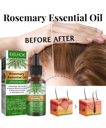 Buy Rosemary Oil for Hair Growth - 30ml Essential Oil | Natural Hair & Skin Care | Nourishes Scalp Eyebrows & Eyelashes (3PCs) - Buy Online on GoSupps.com