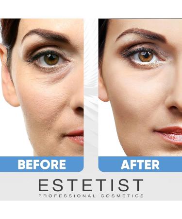 ESTETIST Caffeine Infused Eye Lift Cream - Brightens Dark Circles, Firms Under Eye Bags, & Tightens Sagging Skin - Neck & Chest Firming Cream - Buy Online on GoSupps.com