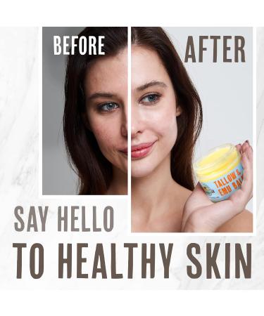 Grassfed Beauty Tallow & Emu Balm (Unscented) - 2 oz | Natural Moisturizer for Skin & Lip Care - Buy Online on GoSupps.com