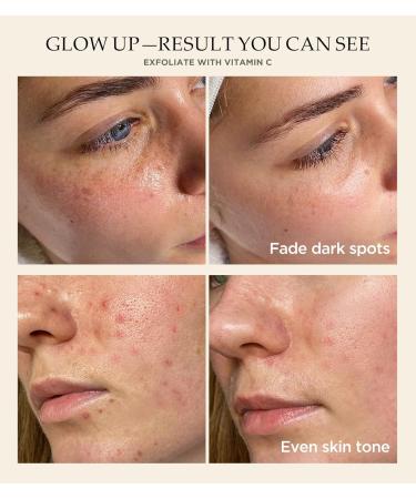 Revitalizing Exfoliation Face Scrub with Vitamin C and Turmeric Gentle Exfoliating Face Wash for Blackheads, Pore Dirt & Dark Spots Daily Balancing Facial Scrub for All Skin Types, 4.23 Fl Oz Turmeric VC - Buy Online on GoSupps.com