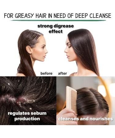 Milva Shampoo for Oily Hair with Nettle Extract - 500 ml Natural Shampoo - Oil-Reducing and Anti-Dandruff Shampoo for Men and Women - Care for Oily Hair - Volume & Shine Shampoo - Buy Online on GoSupps.com